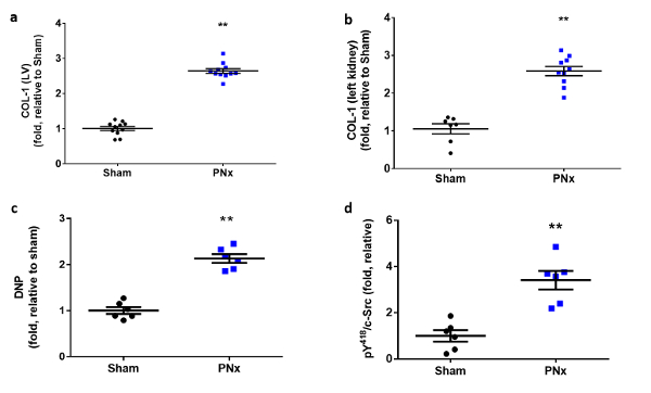 Gene expression comparison in bar graph; COL1, BNP increases post-PNx; statistical analysis indicated.