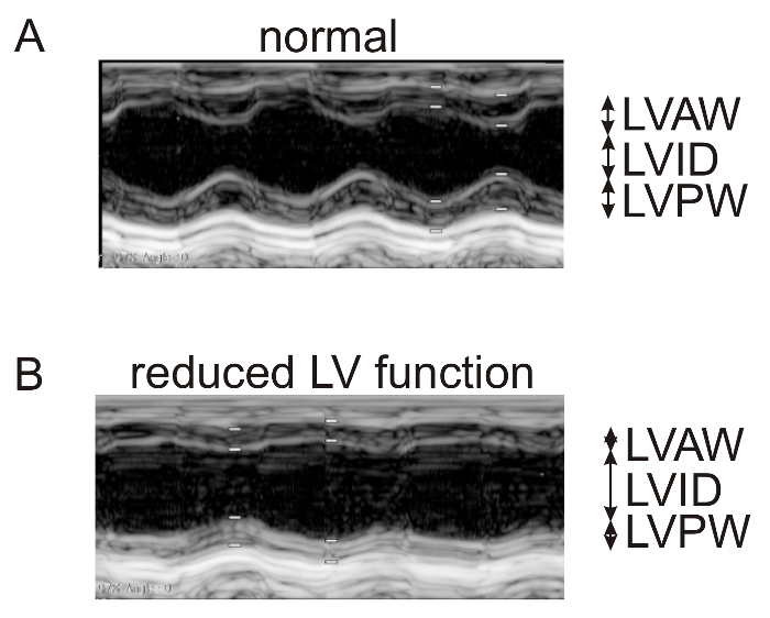 Cardiac ultrasound diagram; normal vs reduced LV function comparison; LVAW, LVID, LVPW indicators.