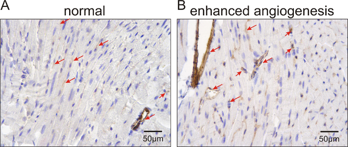 Histological comparison of normal vs enhanced angiogenesis in tissue sections; microscope images.