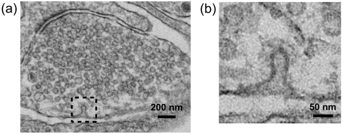 figure-results-4 Electron microscopy showing cellular ultrastructure; scale bars 200 nm and 50 nm.