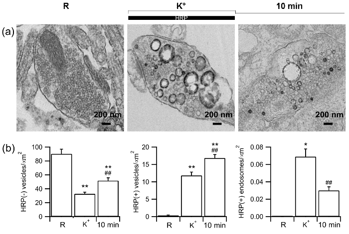 figure-results-5 Cellular endocytosis, HRP uptake, electron micrographs and bar graphs, vesicle quantification.