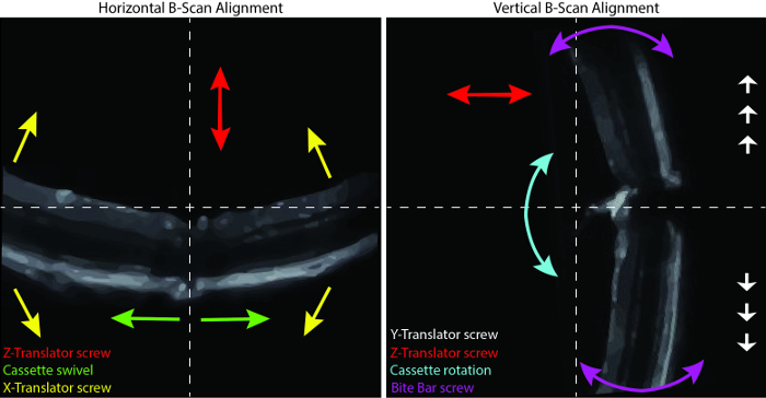 figure-results-2 B-scan alignment process, diagram showing horizontal and vertical screw adjustments for precise imaging.