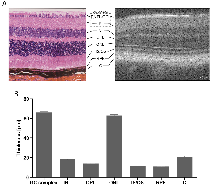figure-results-3 Retinal layer histology and OCT analysis; thickness chart; microscopy, optical coherence tomography.