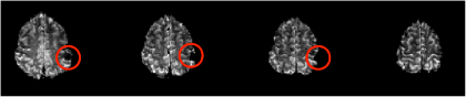 figure-results-4 MRI brain scan sequence analysis, highlighting regions of interest, neuroscience research diagram.