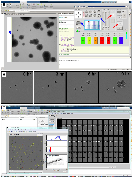 Cell migration analysis; time-lapse microscopy; software interface; image processing setup; growth tracking.