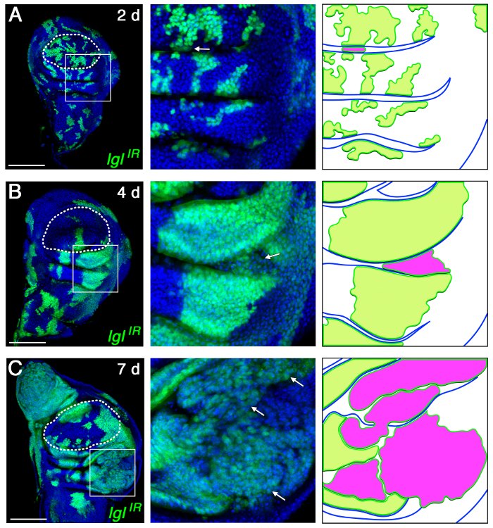 Induction and Diagnosis of Tumors in Drosophila Imaginal Disc Epithelia