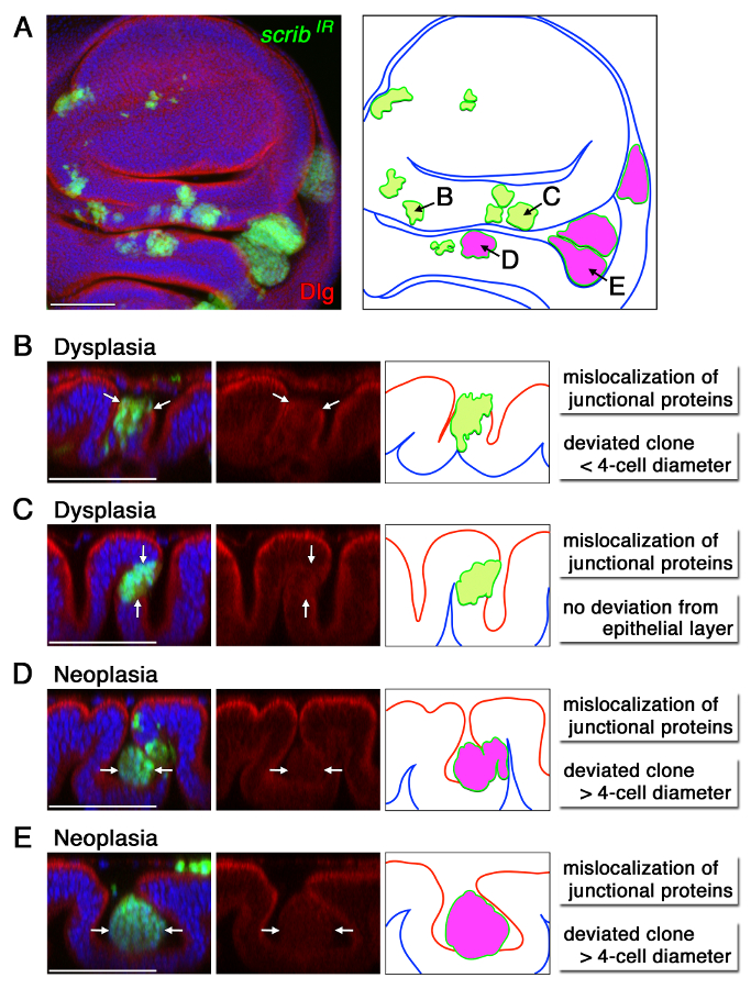 Induction and Diagnosis of Tumors in Drosophila Imaginal Disc Epithelia