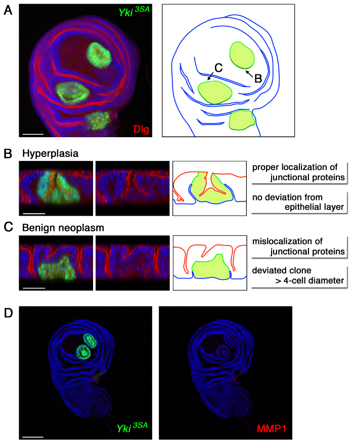 Induction and Diagnosis of Tumors in Drosophila Imaginal Disc Epithelia