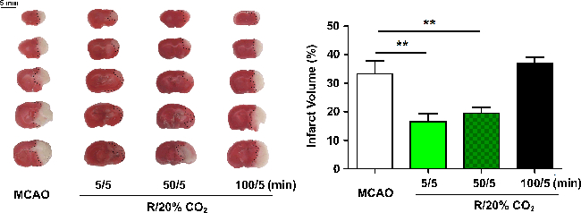 figure-results-2 脑梗死体积分析,TTC染色切片,柱状图比较,CO₂暴露效应。