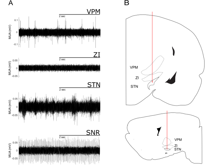 figure-results-2 Neural activity graphs in brain regions; VPM, ZI, STN, SNR; anatomical regions diagram.