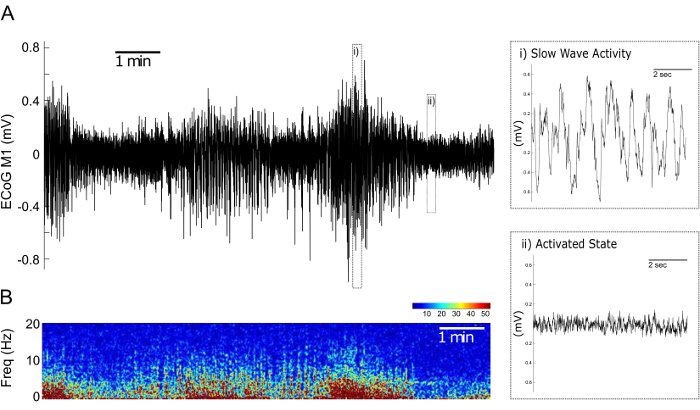 figure-results-3 Electrocorticography results; waveform graphs; brain activity; slow wave; frequency spectrogram.