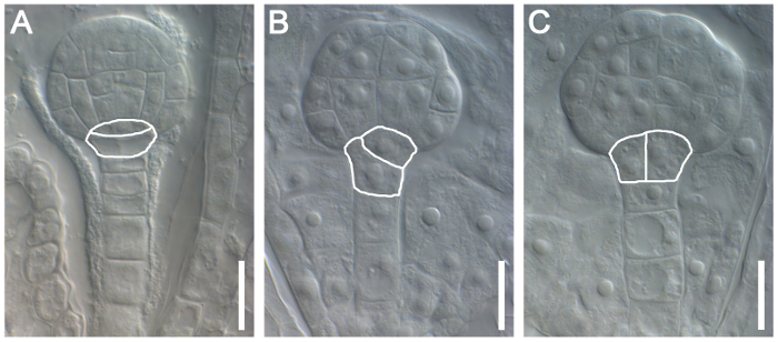figure-results-4 Cellular development stages in microscopy images; diagram highlights structural changes in cells.