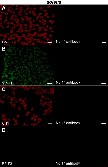 figure-results-1 Immunofluorescence microscopy diagram, soleus muscle, antibodies BA-F8, SC-71, 6H1, BF-F3 analysis.