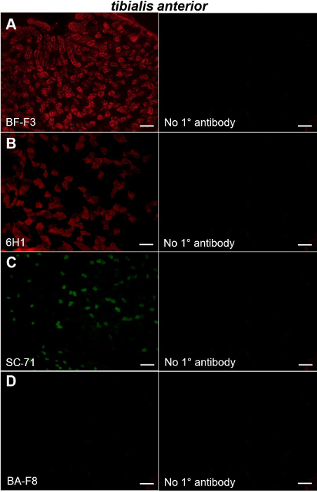 figure-results-2 Tibialis anterior immunofluorescence experiment; proteins labeled; microscopy image comparison.