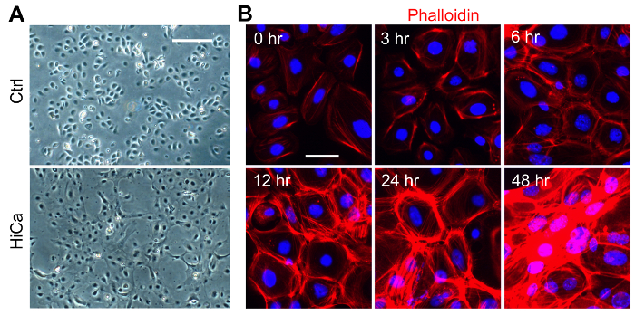 Cell morphology comparison and phalloidin staining; microscopy images; temporal analysis, Ctrl vs HiCa.