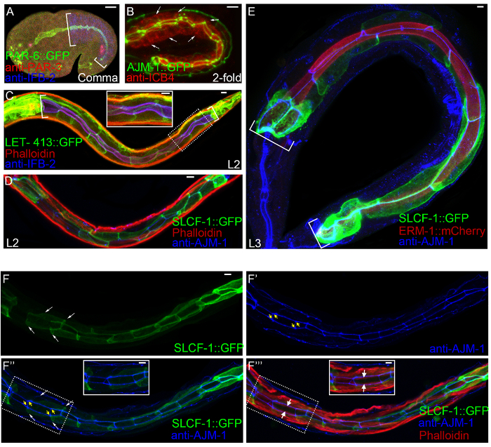 Fluorescence microscopy diagram showing GFP-tagged protein localization in C. elegans embryos.
