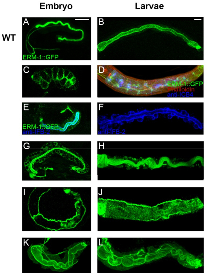 Embryo and larval development; fluorescence microscopy, ERM-1::GFP, phalloidin, anti-IFB-2 staining.