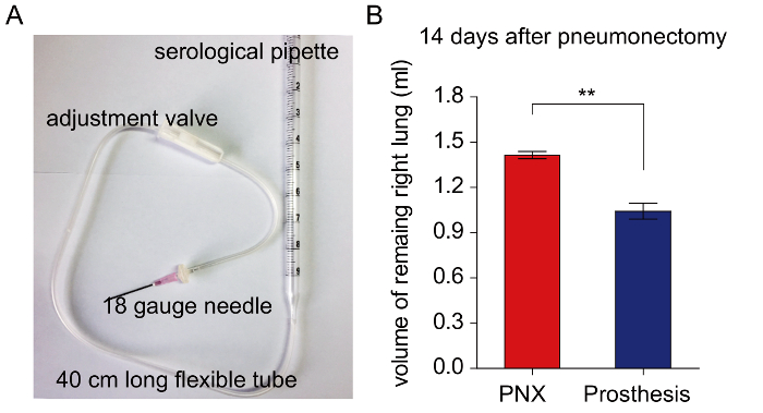 Video: A Standardized Method for Measuring Internal Lung Surface Area ...