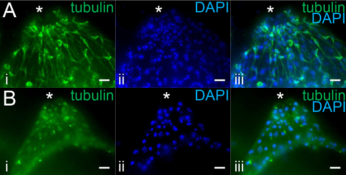 Fluorescence microscopy, tubulin and DAPI staining, cell structure, protein localization analysis.