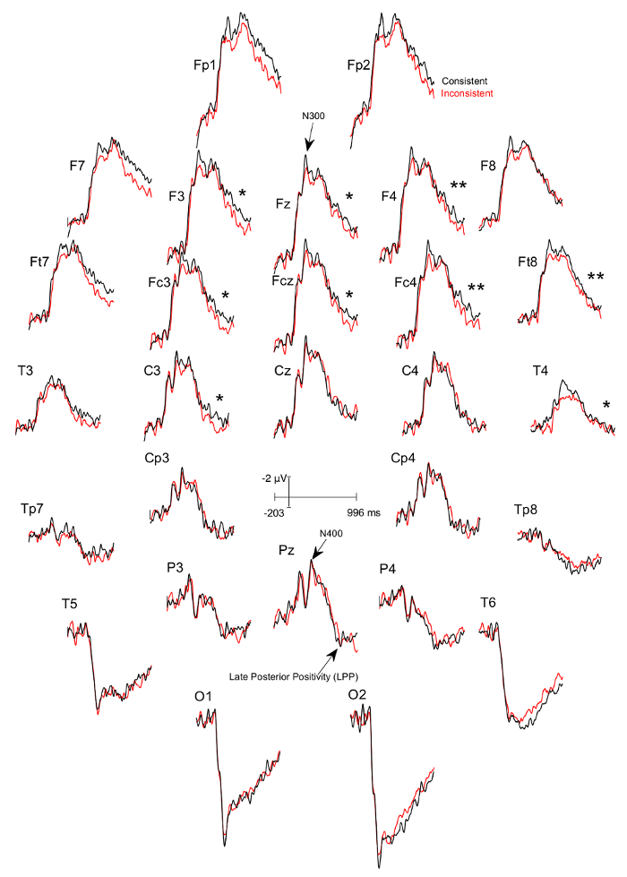 EEG waveform analysis, event-related potentials (ERP) diagram, N300, N400, LPP, brain activity comparison.