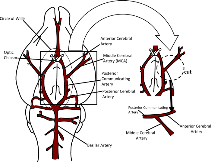 Circle of Willis diagram; cerebral arteries labeled; brain blood flow illustration.