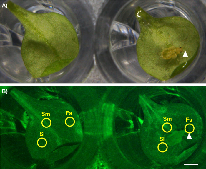 Leaf development comparison, two microscope images; top normal, bottom fluorescence markers, growth analysis.