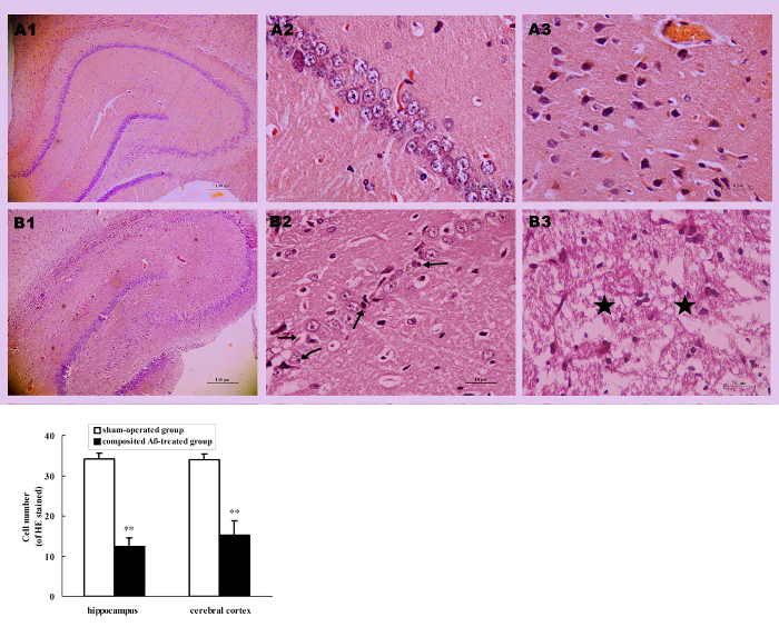 figure-results-5 Histology slides of brain tissue with cell count bar graph showing experimental results.