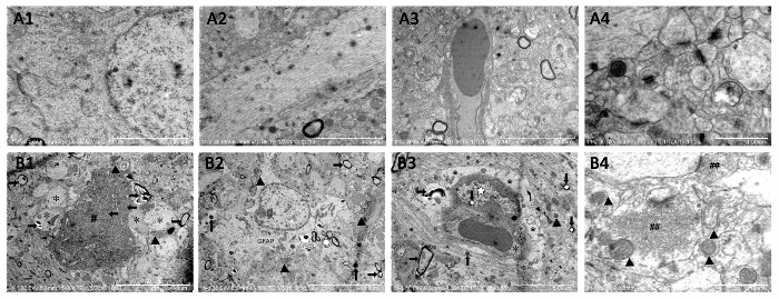 figure-results-6 Electron microscope images showing cellular ultrastructure; organelles, membranes, and cytoplasm.