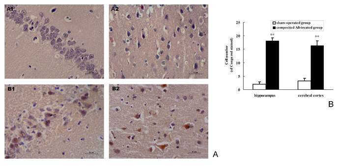 figure-results-7 Histology and bar chart showing cell count comparison; hippocampus, cortex analysis.