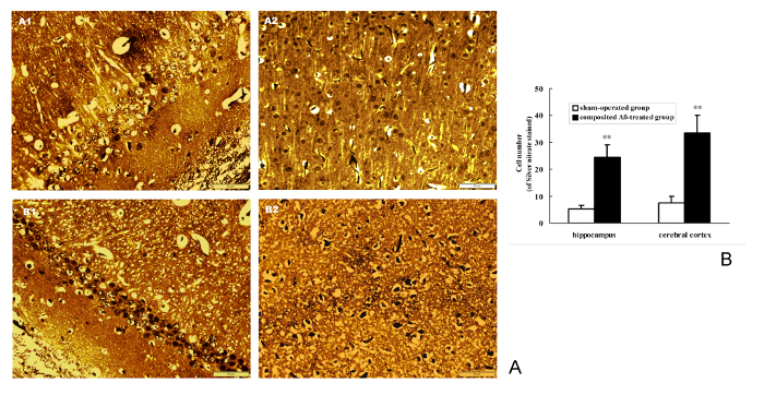 figure-results-8 Histology images and bar graph of cell density; hippocampus, cerebral cortex analysis, AD research.