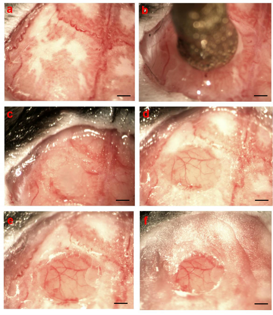 Mouse skin tissue healing stages; microscopy, wound healing observation, cellular regeneration process.