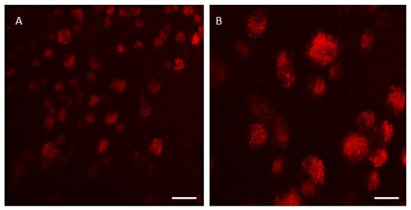 Cell fluorescence microscopy result, red marker analysis, cellular structure visualization, experiment.