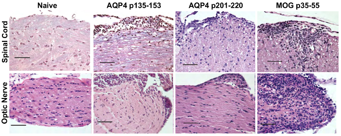 figure-results-5 Histology comparison of spinal cord and optic nerve; immune response in different conditions, diagram.