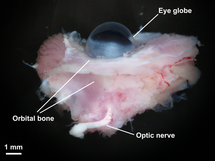 Dissection diagram: Eye anatomy with optic nerve, eye globe, orbital bone labeled for study.