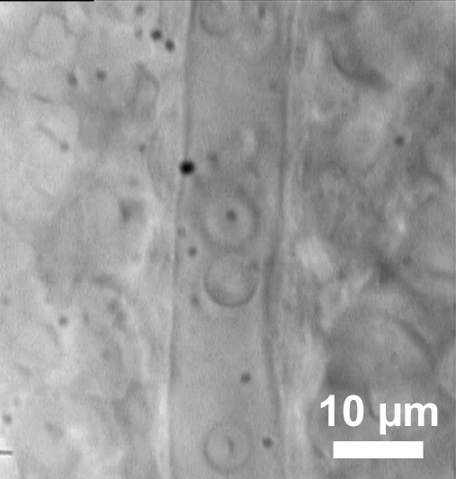 Microscopy image of a cell showing 10 µm scale, highlighting cellular structure at micro level.