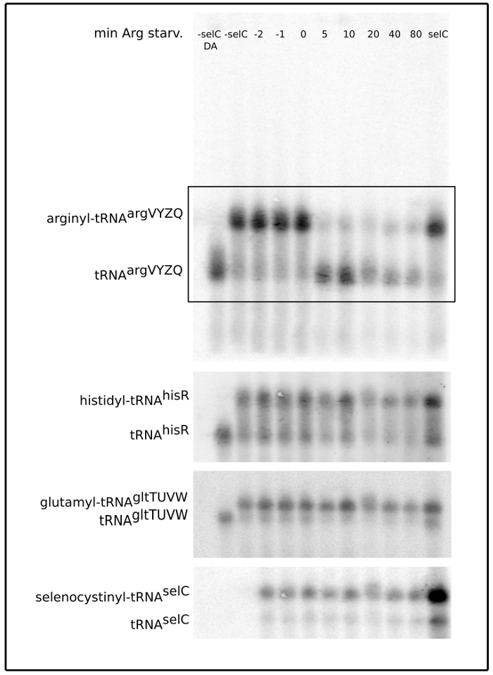 tRNA profiling gel electrophoresis; arginyl-tRNA starvation experiment; protein synthesis analysis.