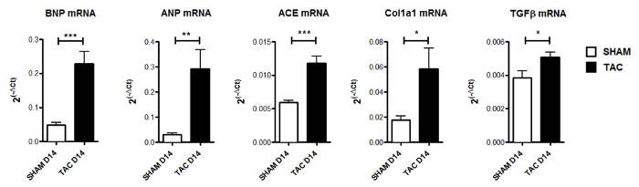figure-results-10 mRNA expression levels diagram; BNP, ANP, ACE, Col1a1, TGFβ in SHAM vs TAC, error bars included.