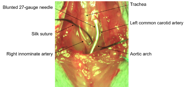 figure-results-6 Surgical procedure diagram showing trachea, arteries, suture using blunted 27-gauge needle technique.