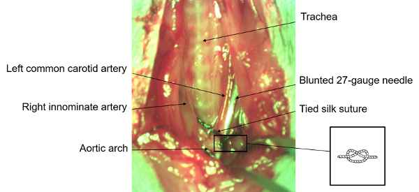 figure-results-7 Surgical setup with labeled arteries, trachea; suture and needle in vascular procedure diagram.
