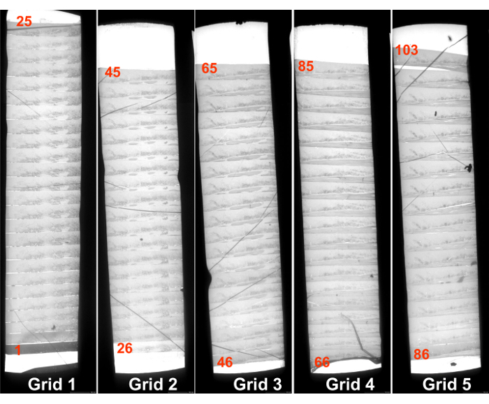 A Method for Obtaining Serial Ultrathin Sections of Microorganisms in ...