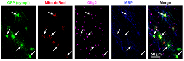 Fluorescence imaging, GFP and Mito-dsRed markers, cell differentiation, microscopy analysis.