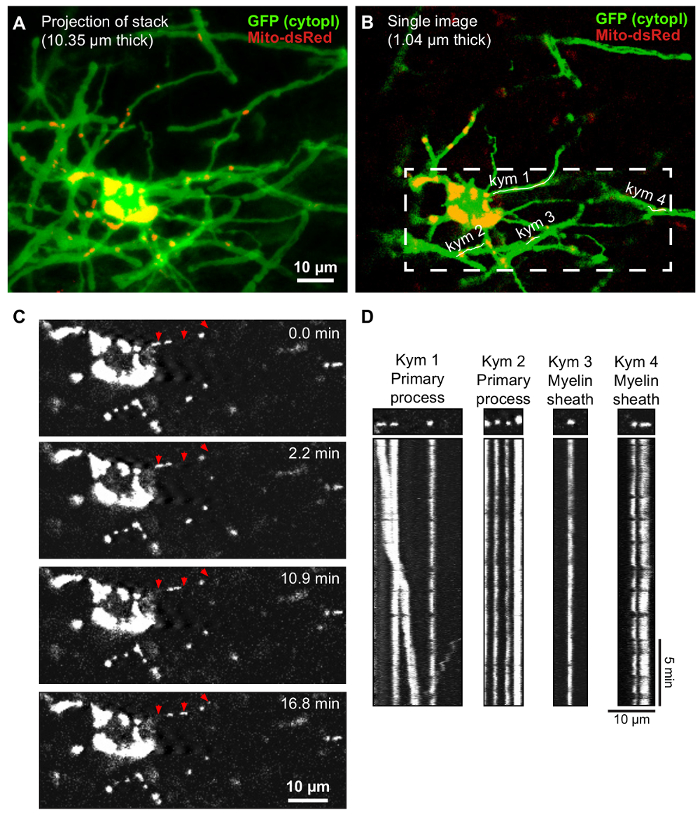 Neuronal mitochondrial transport microscopy; GFP cytoplasm, Mito-dsRed; time-lapse, kymograph.