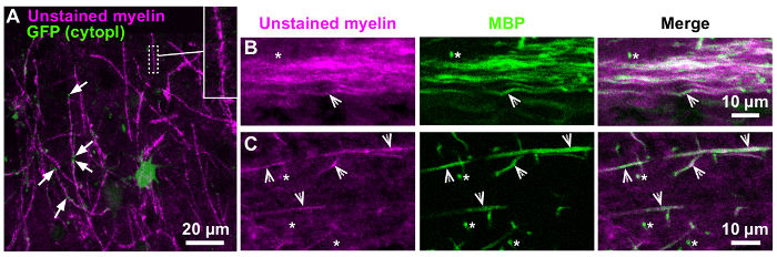 Static equilibrium diagram of myelin fibers with GFP cytoplasm, using fluorescence microscopy.