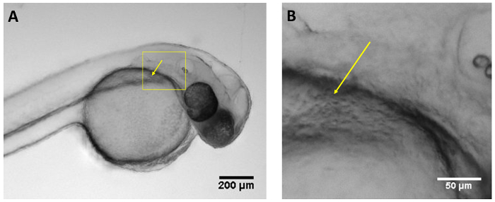 figure-results-1 Zebrafish embryo microscope image with magnified tissue section; developmental biology study.