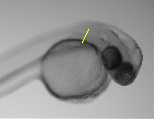 figure-results-4 Zebrafish embryo microscope image, developmental biology, cellular growth study, embryo anatomy.
