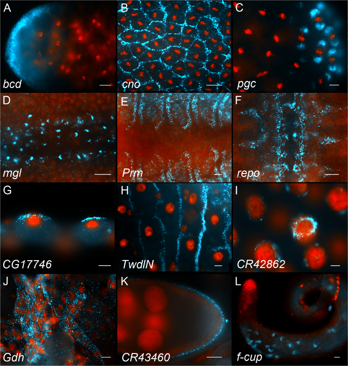 Microscopie à fluorescence des protéines embryonnaires de la drosophile, révélant les modèles d’expression des gènes cellulaires.