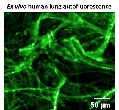 figure-results-1 Ex vivo human lung autofluorescence, microscopic image showing cellular structure, 50 µm scale bar.
