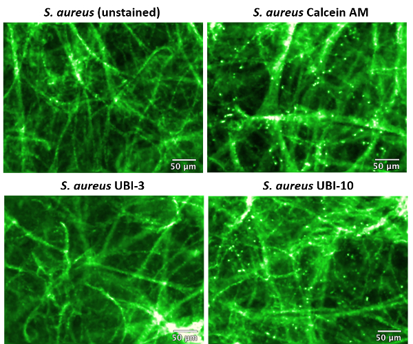figure-results-3 Staphylococcus aureus fluorescence microscopy; stained, unstained; cell viability assay comparison.