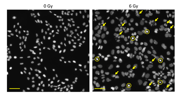 Cell response to radiation, microscopy comparison at 0 Gy and 6 Gy, DNA damage analysis, nuclei.