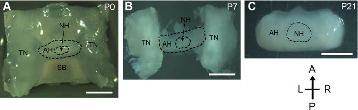 Microscopy image series of neural development, labeled sections (AH, NH, TN), time points P0-P21.